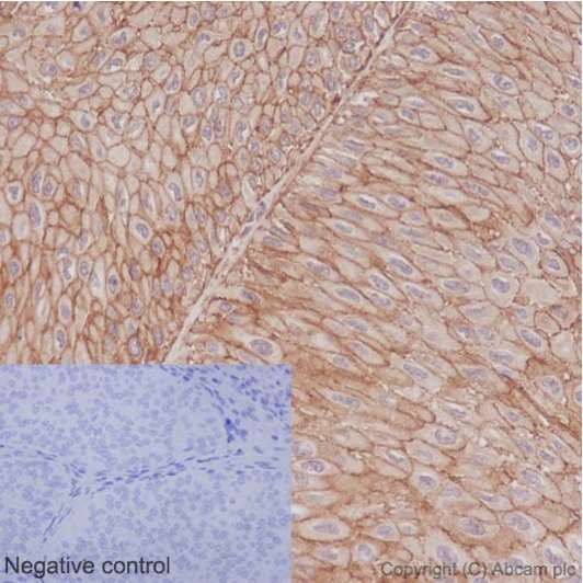 Immunohistochemistry (Formalin/PFA-fixed paraffin-embedded sections) - Anti-PMCA1 antibody [EPR12029] (AB190355), expandable thumbnail