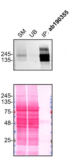 Immunoprecipitation - Anti-PMCA1 antibody [EPR12029] (ab190355), expandable thumbnail
