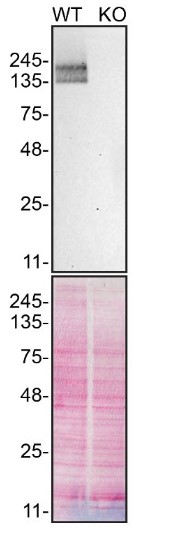 Western blot - Anti-PMCA1 antibody [EPR12029] (ab190355), expandable thumbnail