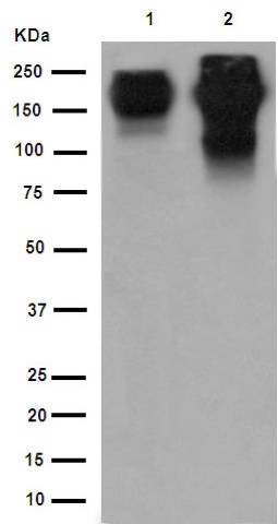 Western blot - Anti-PMCA1 antibody [EPR12029] (AB190355), expandable thumbnail