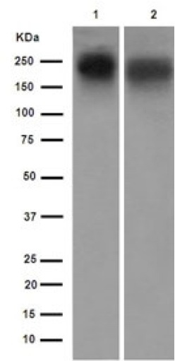 Western blot - Anti-PMCA1 antibody [EPR12029] (AB190355), expandable thumbnail