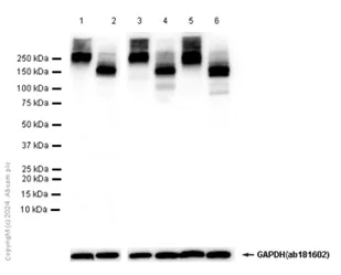 Western blot - Anti-PMCA1 antibody [EPR12029] - BSA and Azide free (AB251018)