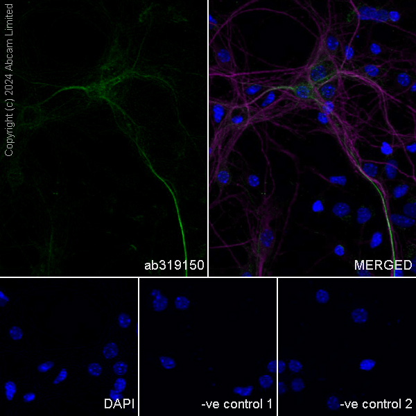 Immunocytochemistry/ Immunofluorescence - Anti-PMCA2 antibody [EPR28923-56] - BSA and Azide free (AB319151), expandable thumbnail