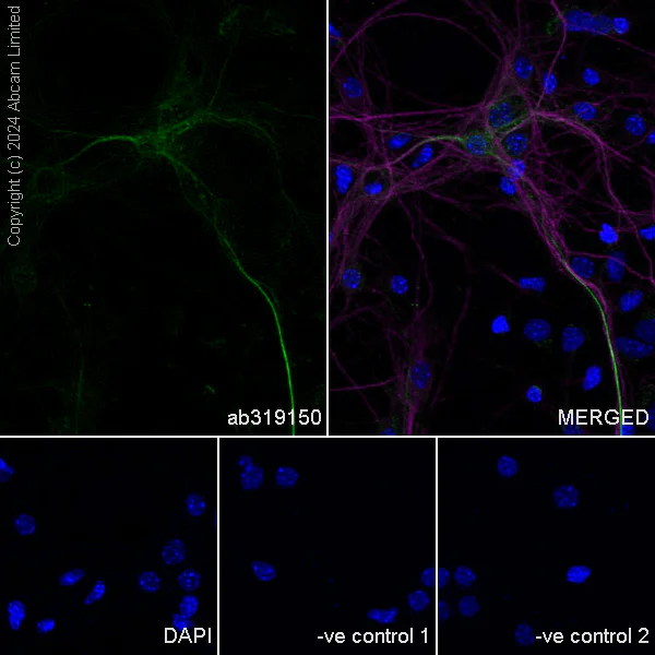 Immunocytochemistry/ Immunofluorescence - Anti-PMCA2 antibody [EPR28923-56] - BSA and Azide free (AB319151)