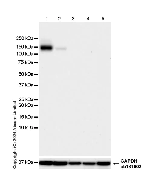 Western blot - Anti-PMCA2 antibody [EPR28923-56] - BSA and Azide free (AB319151)