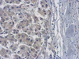 Immunohistochemistry (Formalin/PFA-fixed paraffin-embedded sections) - Anti-PME-1 antibody (AB154569)