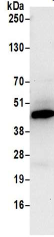 Immunoprecipitation - Anti-PME-1 antibody (AB205956)