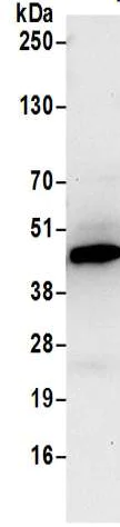 Immunoprecipitation - Anti-PME-1 antibody (AB205956)
