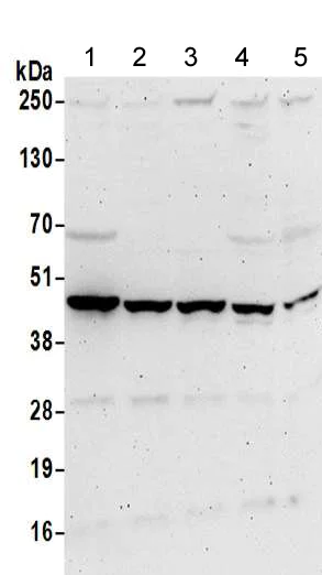 Western blot - Anti-PME-1 antibody (AB205956)