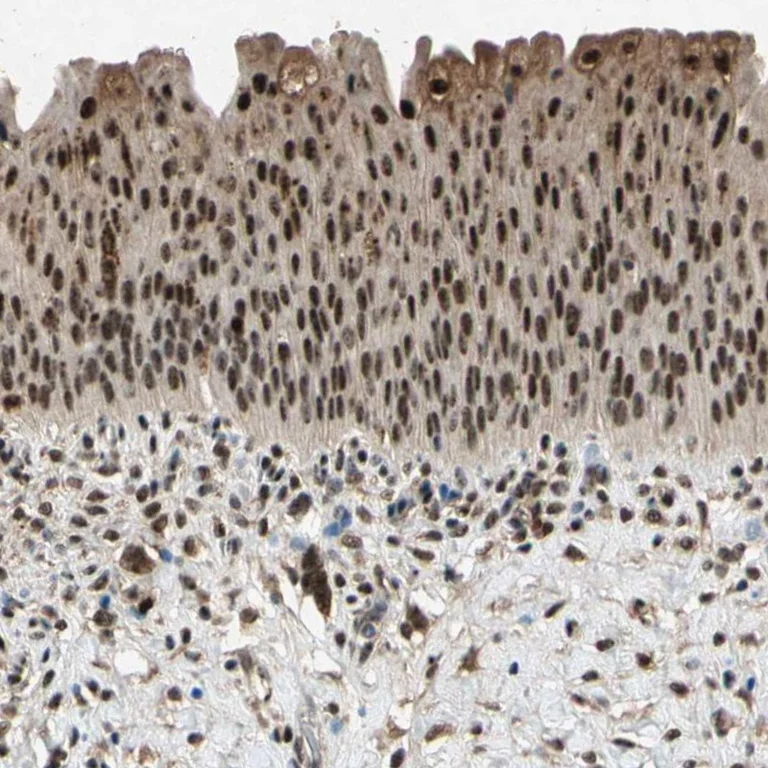 Immunohistochemistry (Formalin/PFA-fixed paraffin-embedded sections) - Anti-PML Antibody (AB327189)