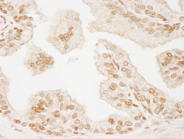 Immunohistochemistry (Formalin/PFA-fixed paraffin-embedded sections) - Anti-PML Protein antibody (AB245337), expandable thumbnail