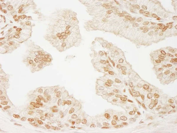 Immunohistochemistry (Formalin/PFA-fixed paraffin-embedded sections) - Anti-PML Protein antibody (AB245337)