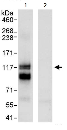 Immunoprecipitation - Anti-PML Protein antibody (AB245337), expandable thumbnail