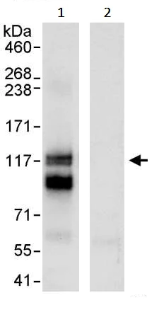 Immunoprecipitation - Anti-PML Protein antibody (AB245337)