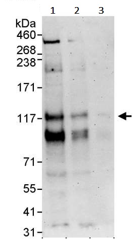 Western blot - Anti-PML Protein antibody (AB245337), expandable thumbnail