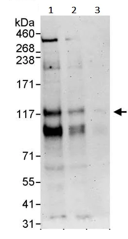 Western blot - Anti-PML Protein antibody (AB245337)