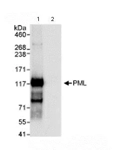 Immunoprecipitation - Anti-PML Protein antibody (AB72137)