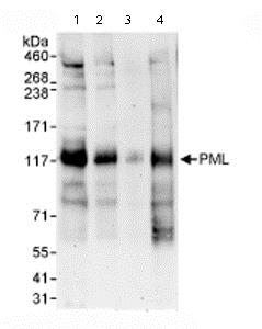 Western blot - Anti-PML Protein antibody (AB72137)