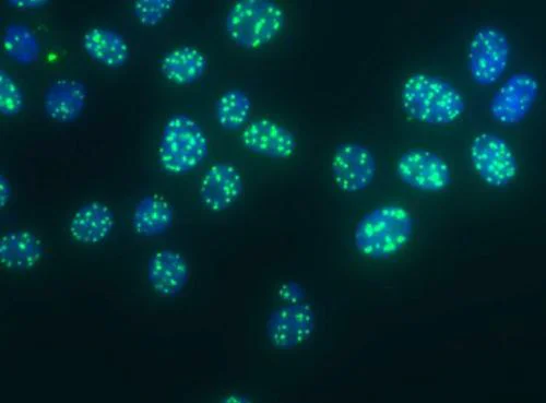 Immunocytochemistry/ Immunofluorescence - Anti-PML Protein antibody [C7] (AB96051)