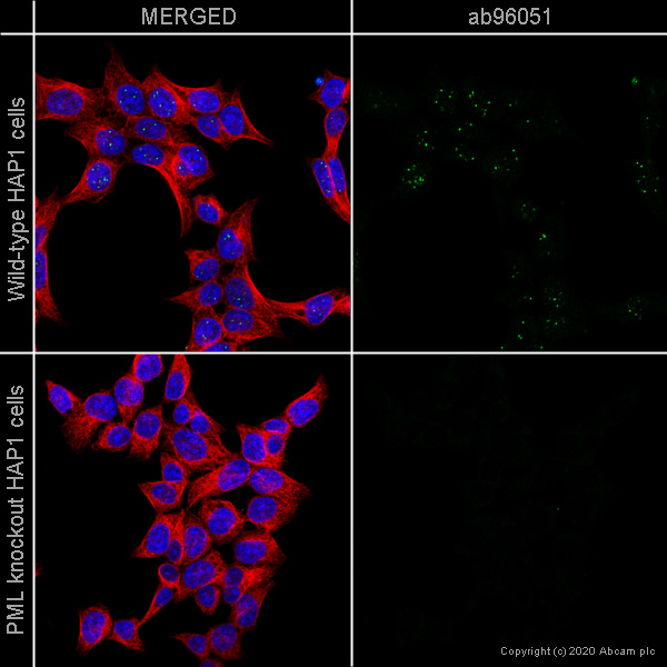 Immunocytochemistry/ Immunofluorescence - Anti-PML Protein antibody [C7] (AB96051)