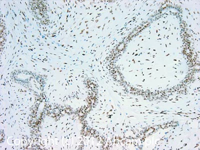 Immunohistochemistry (Formalin/PFA-fixed paraffin-embedded sections) - Anti-PML Protein antibody [C7] (AB96051)