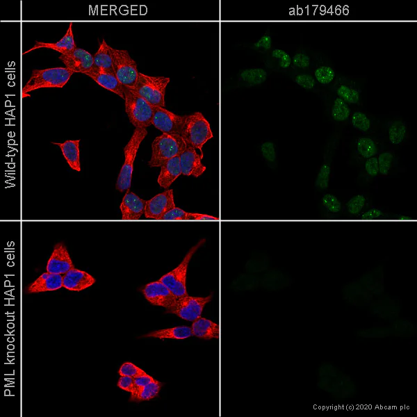 Immunocytochemistry/ Immunofluorescence - Anti-PML Protein antibody [EPR16792] (AB179466)