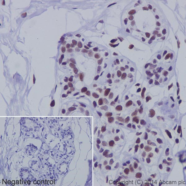 Immunohistochemistry (Formalin/PFA-fixed paraffin-embedded sections) - Anti-PML Protein antibody [EPR16792] (AB179466)
