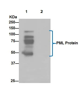 Immunoprecipitation - Anti-PML Protein antibody [EPR16792] (AB179466)