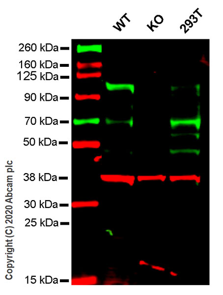 Western blot - Anti-PML Protein antibody [EPR16792] (AB179466)