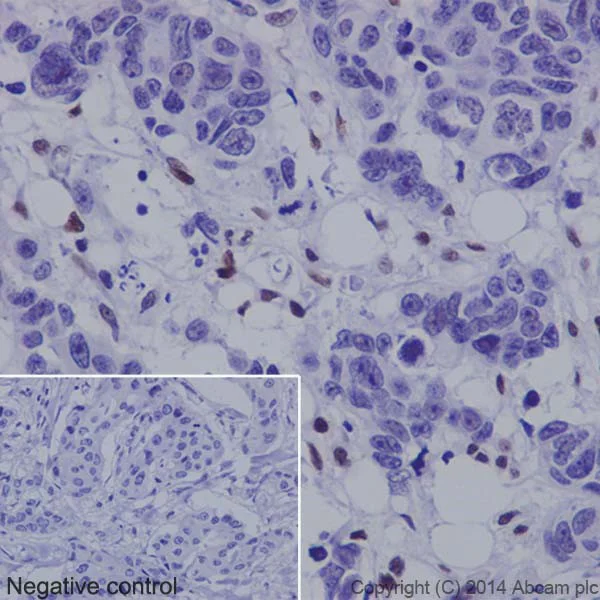 Immunohistochemistry (Formalin/PFA-fixed paraffin-embedded sections) - Anti-PML Protein antibody [EPR16792] - BSA and Azide free (AB240213)