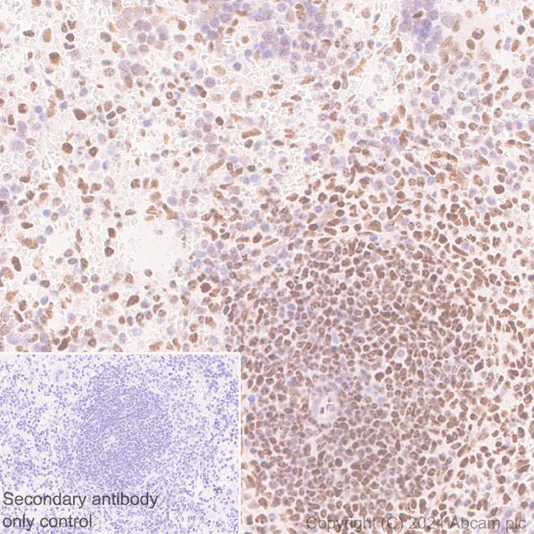 Immunohistochemistry (Formalin/PFA-fixed paraffin-embedded sections) - Anti-PML Protein antibody [EPR27157-75] (AB317018)