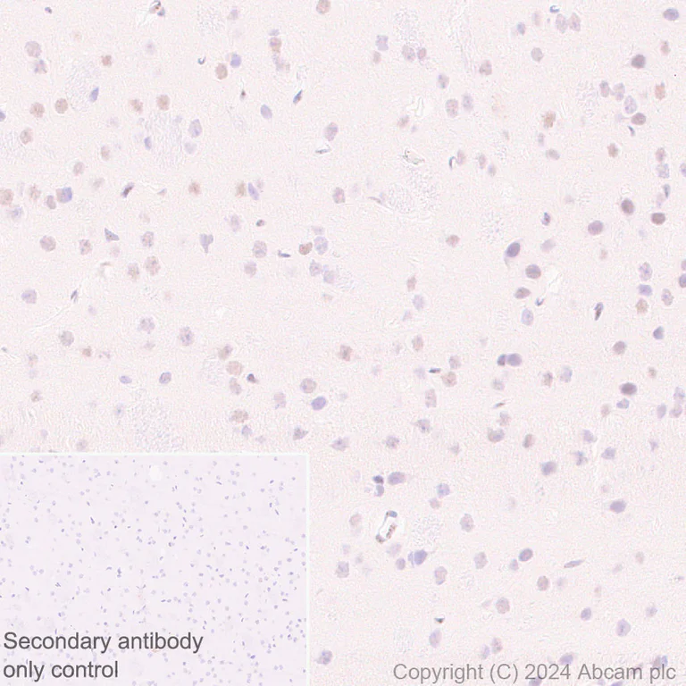 Immunohistochemistry (Formalin/PFA-fixed paraffin-embedded sections) - Anti-PML Protein antibody [EPR27157-75] (AB317018)