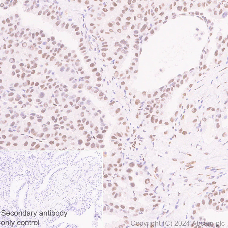 Immunohistochemistry (Formalin/PFA-fixed paraffin-embedded sections) - Anti-PML Protein antibody [EPR27157-75] (AB317018)