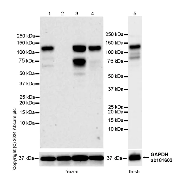 Western blot - Anti-PML Protein antibody [EPR27157-75] (AB317018)