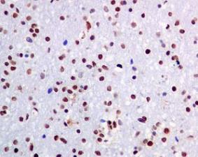 Immunohistochemistry (Formalin/PFA-fixed paraffin-embedded sections) - Anti-PML Protein (phospho S518) antibody [EPR6151] (AB128932)