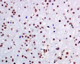 Immunohistochemistry (Formalin/PFA-fixed paraffin-embedded sections) - Anti-PML Protein (phospho S518) antibody [EPR6151] (AB128932)