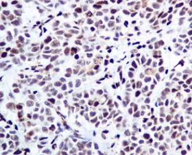 Immunohistochemistry (Formalin/PFA-fixed paraffin-embedded sections) - Anti-PML Protein (phospho S518) antibody [EPR6151] - BSA and Azide free (AB184769)