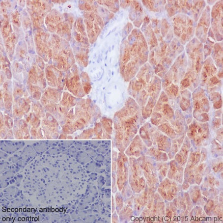 Immunohistochemistry (Formalin/PFA-fixed paraffin-embedded sections) - Anti-PMM1 antibody [EPR17844] (ab202058), expandable thumbnail