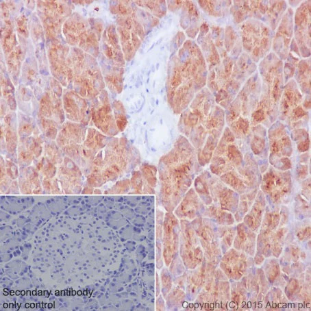 Immunohistochemistry (Formalin/PFA-fixed paraffin-embedded sections) - Anti-PMM1 antibody [EPR17844] (AB202058)