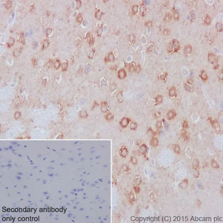 Immunohistochemistry (Formalin/PFA-fixed paraffin-embedded sections) - Anti-PMM1 antibody [EPR17844] - BSA and Azide free (AB251358)