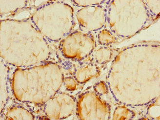 Immunohistochemistry (Formalin/PFA-fixed paraffin-embedded sections) - Anti-PMM2 antibody (AB229996), expandable thumbnail