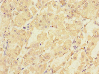 Immunohistochemistry (Formalin/PFA-fixed paraffin-embedded sections) - Anti-PMM2 antibody (AB229996), expandable thumbnail