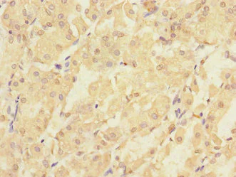 Immunohistochemistry (Formalin/PFA-fixed paraffin-embedded sections) - Anti-PMM2 antibody (AB229996)