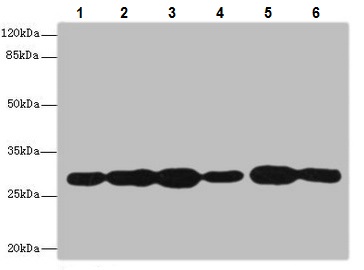 Western blot - Anti-PMM2 antibody (AB229996), expandable thumbnail