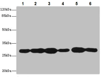 Western blot - Anti-PMM2 antibody (AB229996)