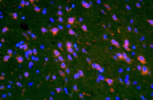 Immunohistochemistry (Formalin/PFA-fixed paraffin-embedded sections) - Anti-PMP2 antibody (AB203249)