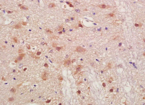 Immunohistochemistry (Formalin/PFA-fixed paraffin-embedded sections) - Anti-PMP2 antibody (AB203249)