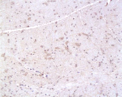 Immunohistochemistry (Formalin/PFA-fixed paraffin-embedded sections) - Anti-PMP22 antibody (AB203053)