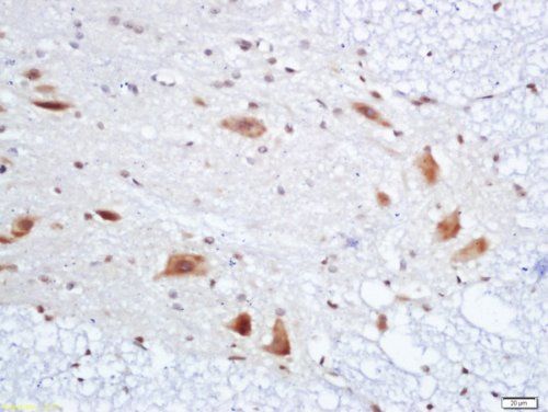 Immunohistochemistry (Formalin/PFA-fixed paraffin-embedded sections) - Anti-PMP22 antibody (AB203053)