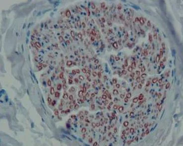 Immunohistochemistry (Formalin/PFA-fixed paraffin-embedded sections) - Anti-PMP22 antibody [CF1] (AB90782)